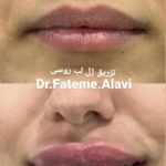 دکتر سیده فاطمه علوی لنگرودی در تهران