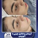 دکتر فرزانه برزگری در یزد