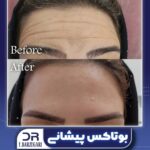 دکتر فرزانه برزگری در یزد