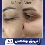 دکتر فرزانه برزگری در یزد