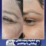 دکتر فرزانه برزگری در یزد