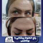 دکتر فرزانه برزگری در یزد