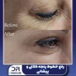 دکتر فرزانه برزگری در یزد