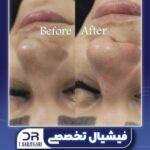 دکتر فرزانه برزگری در یزد