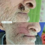 دکتر سعید عباسی معین در بندر انزلی