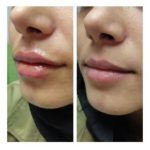 دکتر سعید عباسی معین در بندر انزلی