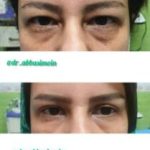 دکتر سعید عباسی معین در بندر انزلی