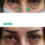 دکتر سعید عباسی معین در بندر انزلی