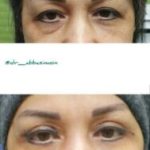 دکتر سعید عباسی معین در بندر انزلی