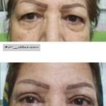 دکتر سعید عباسی معین در بندر انزلی