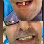 دکتر نبی اله هدایت پور در بابل