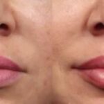 دکتر حمید کوهستانی در کرمان