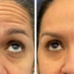 دکتر حمید کوهستانی در کرمان