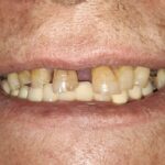 دکتر امیر محزون دندانپزشک عمومی در مشهد