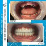 دکتر محسن ایوبی دندانپزشک در تهران