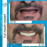 دکتر محسن ایوبی دندانپزشک در تهران