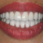 دکتر آزیتا هدایتی دندانپزشک در بندرعباس