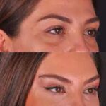 دکتر پرویز مافی در تهران