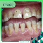 دکتر رضا قلی پور راد در بابل