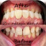 مطب دندانپزشکی دکتر طلایه کاتبی در قزوین