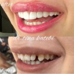 مطب دندانپزشکی دکتر طلایه کاتبی در قزوین