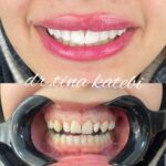 مطب دندانپزشکی دکتر طلایه کاتبی در قزوین