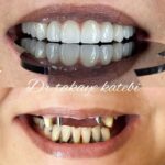 مطب دندانپزشکی دکتر طلایه کاتبی در قزوین