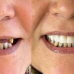 مطب دندانپزشکی دکتر طلایه کاتبی در قزوین