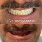 مطب دندانپزشکی دکتر طلایه کاتبی در قزوین