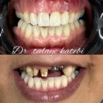 مطب دندانپزشکی دکتر طلایه کاتبی در قزوین