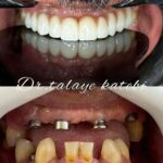 مطب دندانپزشکی دکتر طلایه کاتبی در قزوین