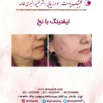 دکتر فهیمه اکبری طامه متخصص زیبایی در ستارخان