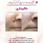 دکتر فهیمه اکبری طامه متخصص زیبایی در ستارخان