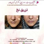 دکتر فهیمه اکبری طامه متخصص زیبایی در ستارخان