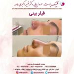 دکتر فهیمه اکبری طامه متخصص زیبایی در ستارخان