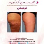 دکتر فهیمه اکبری طامه متخصص زیبایی در ستارخان