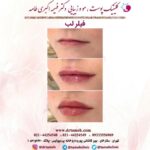 دکتر فهیمه اکبری طامه متخصص زیبایی در ستارخان