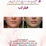 دکتر فهیمه اکبری طامه متخصص زیبایی در ستارخان