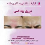 دکتر فهیمه اکبری طامه متخصص زیبایی در ستارخان