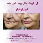 دکتر فهیمه اکبری طامه متخصص زیبایی در ستارخان