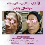 دکتر فهیمه اکبری طامه متخصص زیبایی در ستارخان