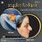 دکتر سولماز علیپور خباز پیشه در لاهیجان