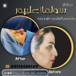 دکتر ساناز علیپور جناز پشته در لاهیجان