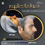 دکتر سولماز علیپور خباز پیشه در لاهیجان