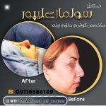 دکتر سولماز علیپور خباز پیشه در لاهیجان