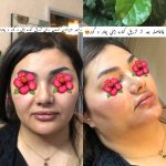 مرکز زیبایی پارسیان رخ در تهران