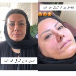 مرکز زیبایی پارسیان رخ در تهران
