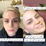 مرکز زیبایی پارسیان رخ در تهران