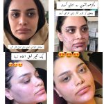 مرکز زیبایی پارسیان رخ در تهران