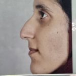 دکتر عادل ایمانی پرشکوه در رشت